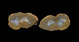 79 bed thunderegg